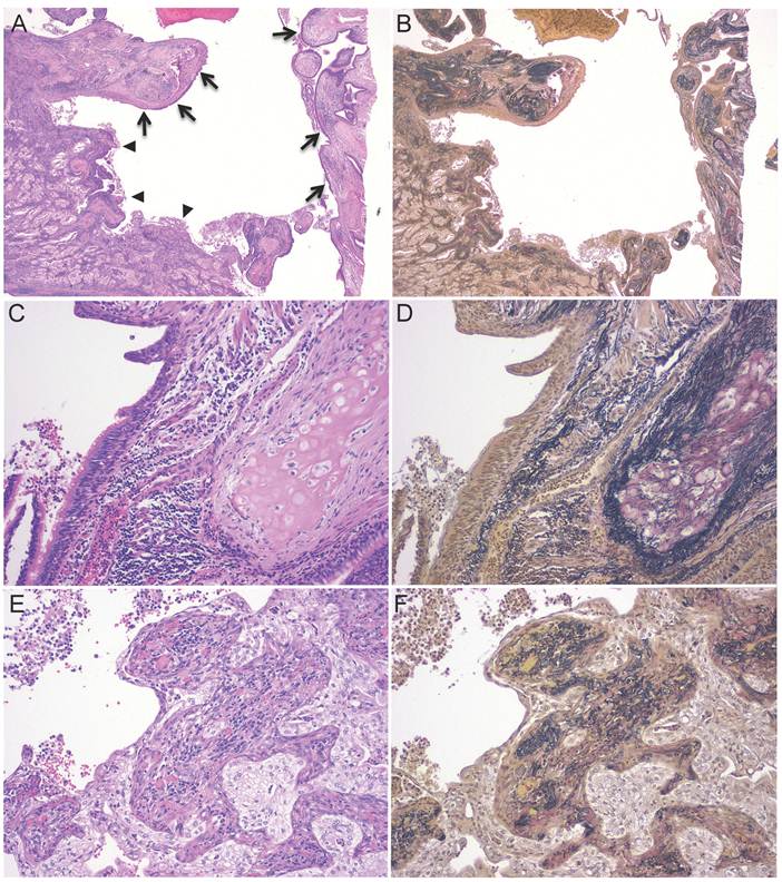 J Cancer Image