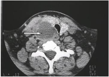 J Cancer Image