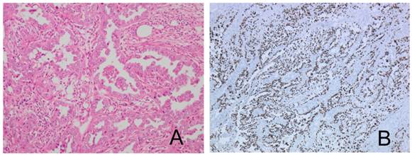 J Cancer Image