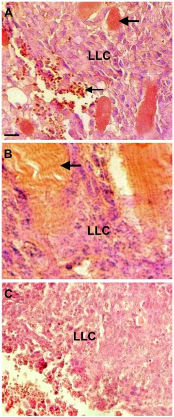 J Cancer Image