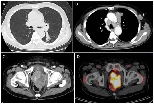 J Cancer Image