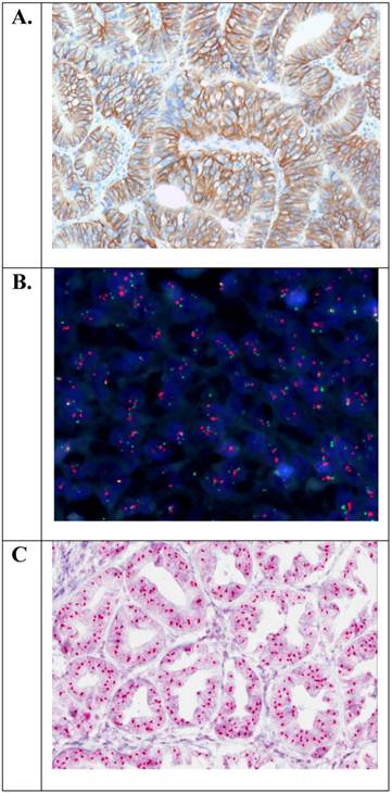 J Cancer Image