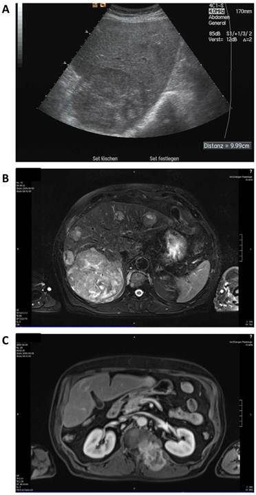 J Cancer Image