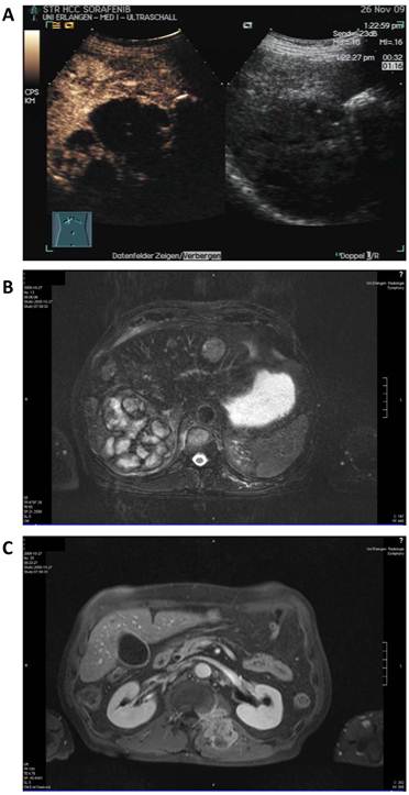 J Cancer Image