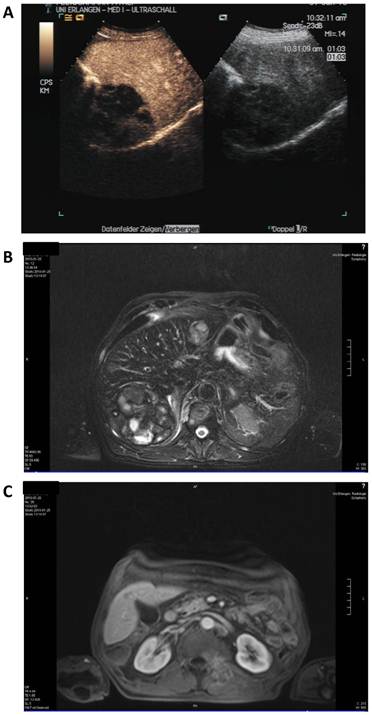 J Cancer Image