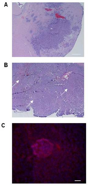 J Cancer Image