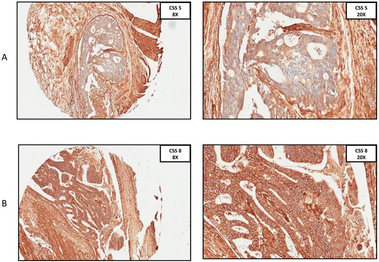 J Cancer Image