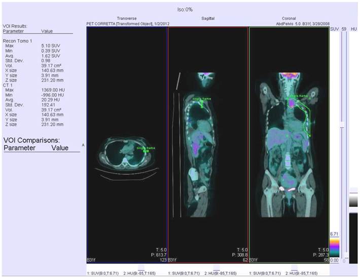 J Cancer Image