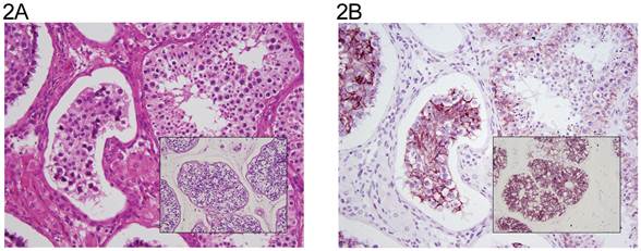 J Cancer Image