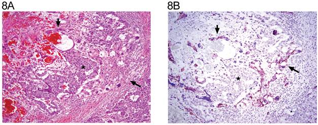 J Cancer Image