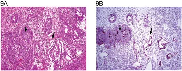 J Cancer Image