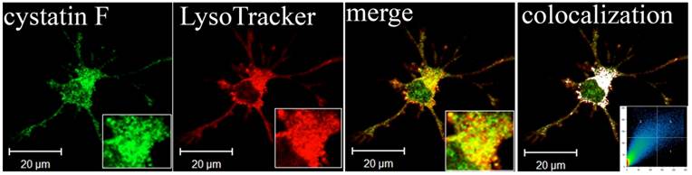 J Cancer Image