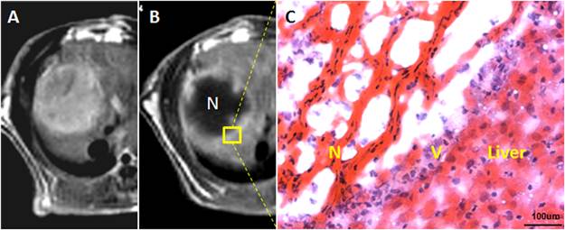 J Cancer Image