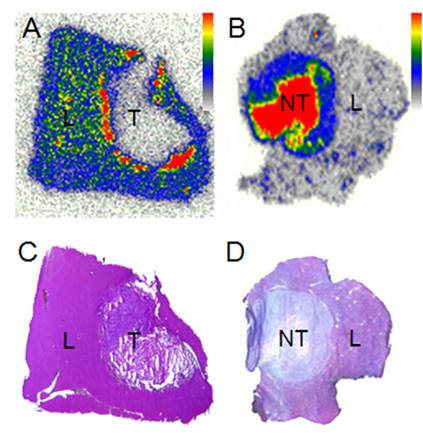 J Cancer Image