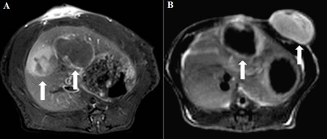 J Cancer Image