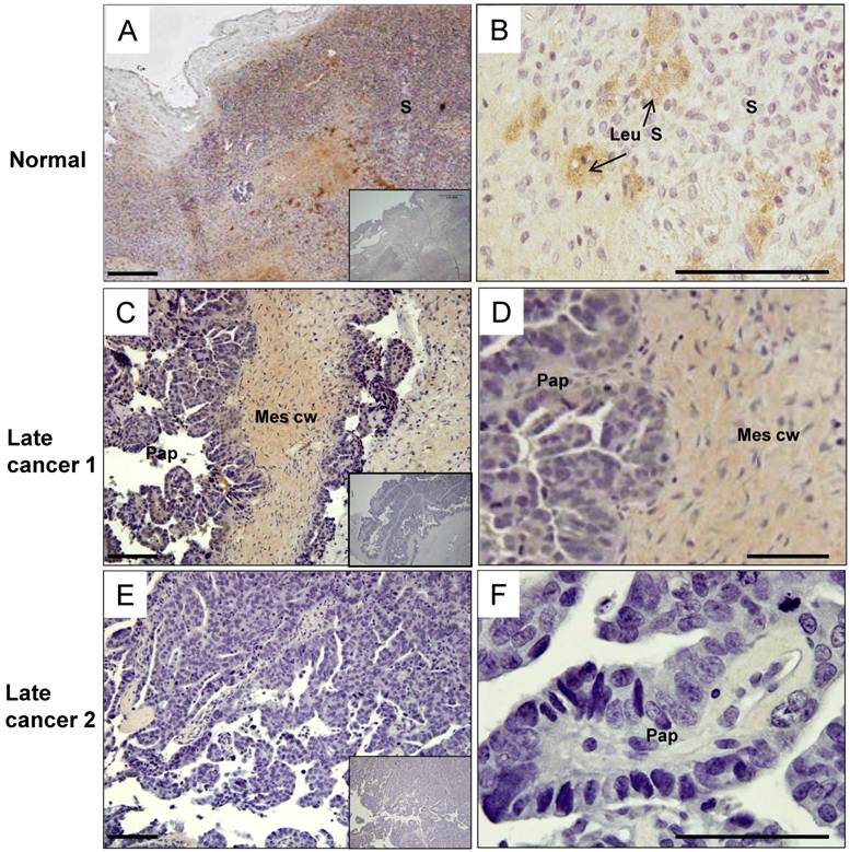 J Cancer Image