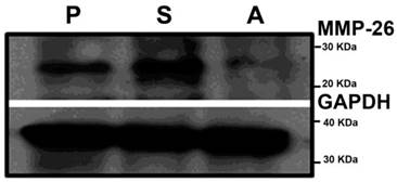 J Cancer Image