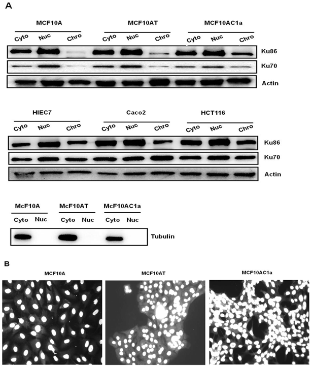 J Cancer Image