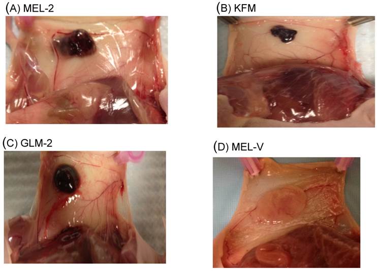 J Cancer Image