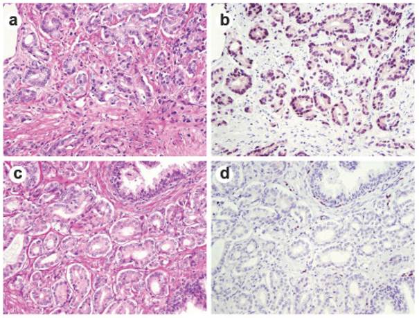 J Cancer Image