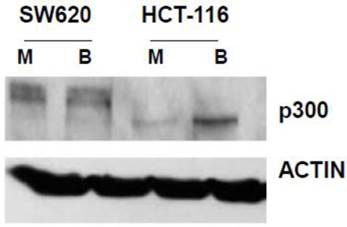 J Cancer Image