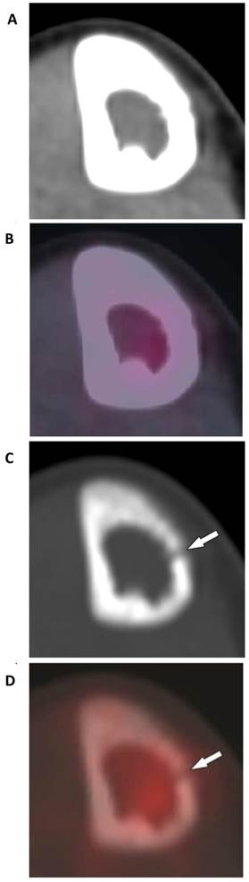 J Cancer Image