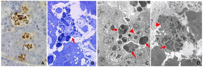 J Cancer Image