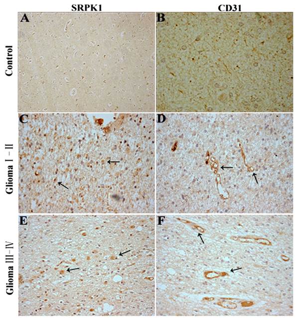 J Cancer Image