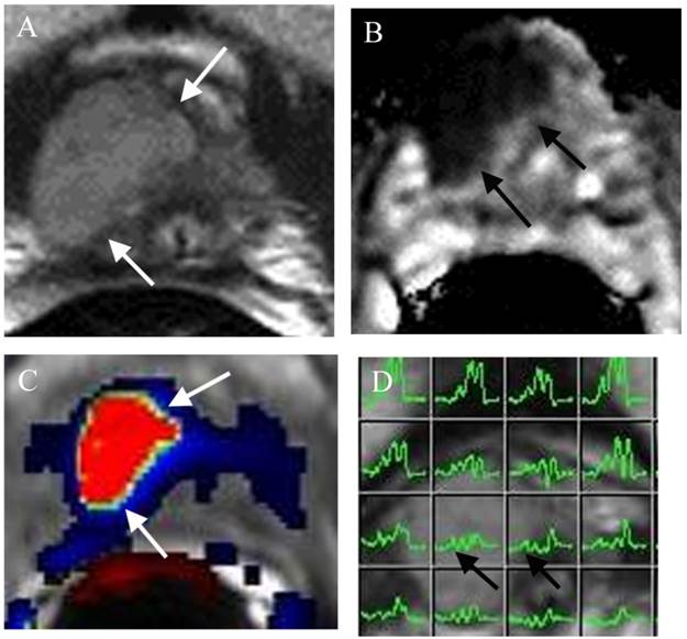 J Cancer Image