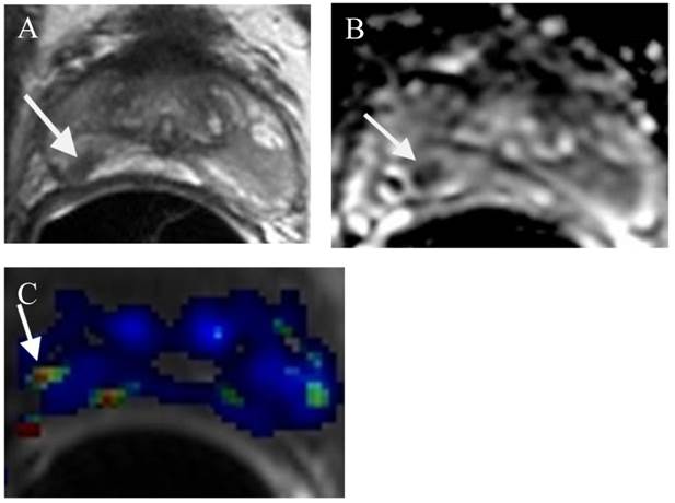 J Cancer Image