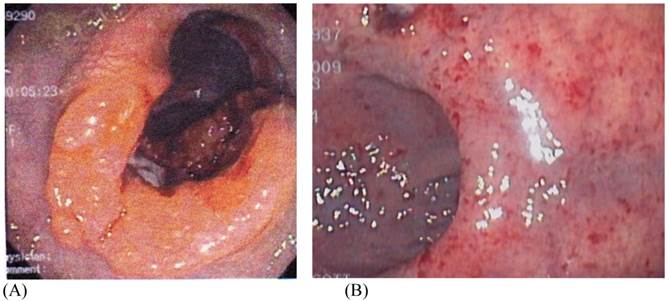 J Cancer Image