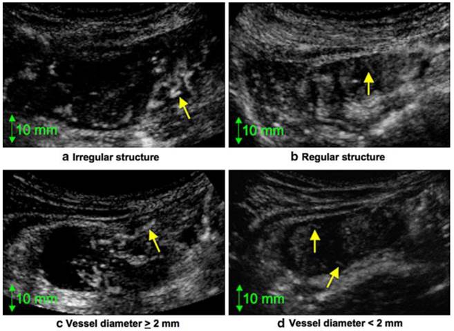 J Cancer Image