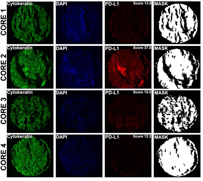 J Cancer Image