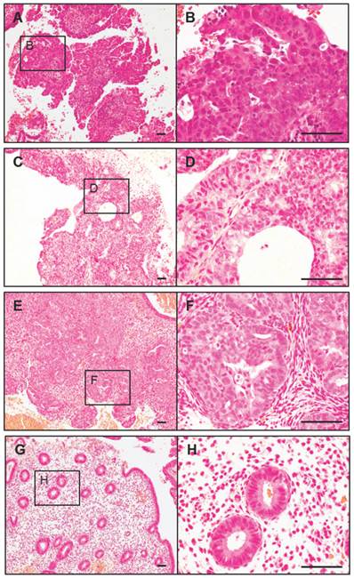 J Cancer Image