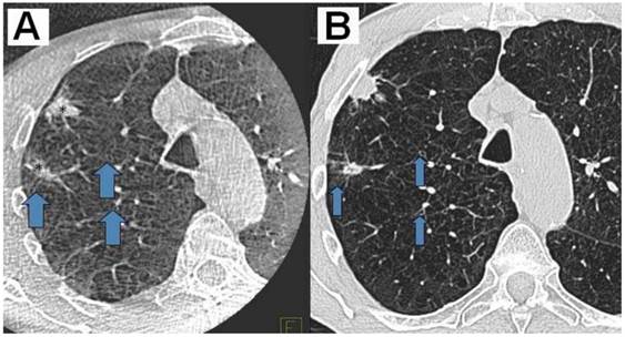 J Cancer Image