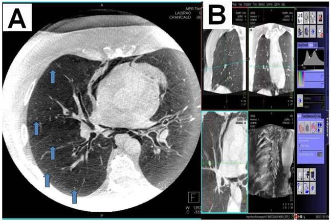 J Cancer Image