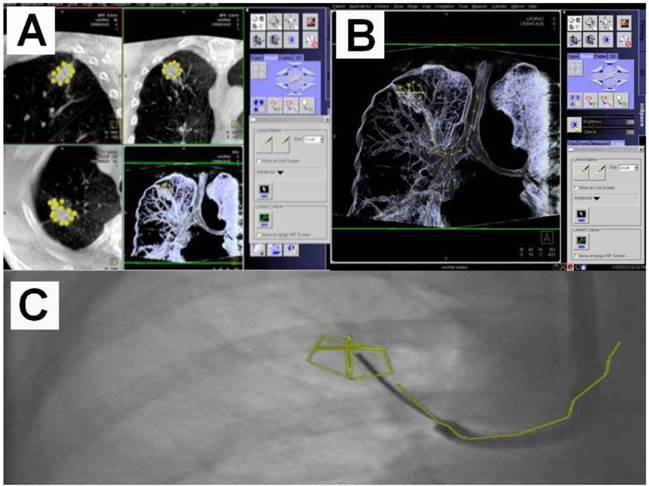 J Cancer Image