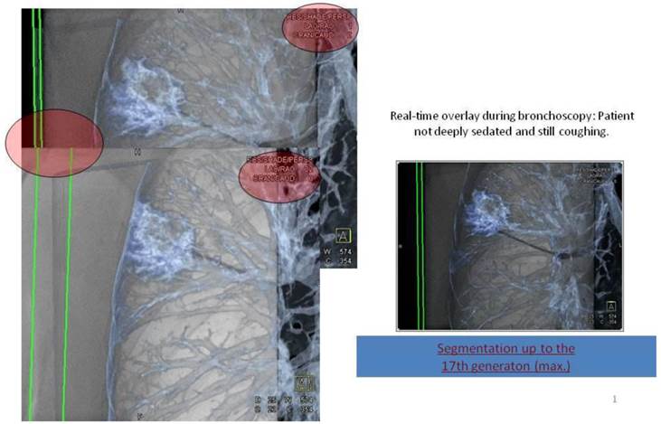 J Cancer Image