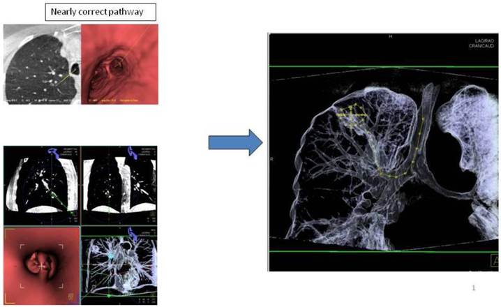 J Cancer Image