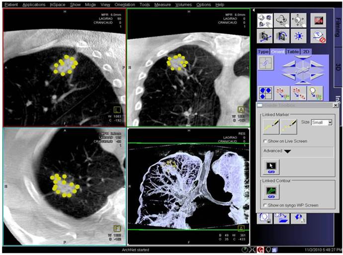 J Cancer Image