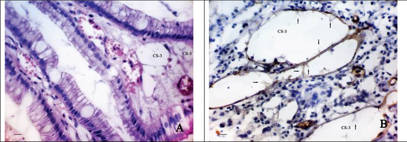 J Cancer Image