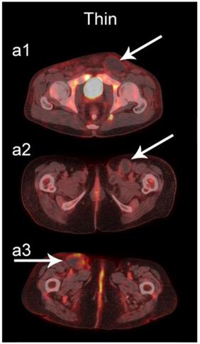 J Cancer Image