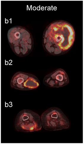 J Cancer Image