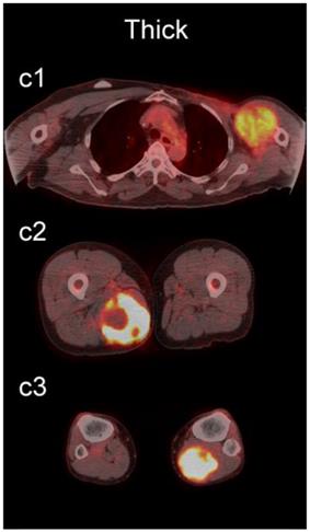 J Cancer Image