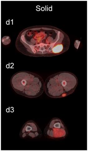 J Cancer Image