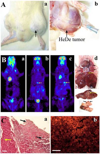 J Cancer Image