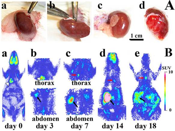 J Cancer Image