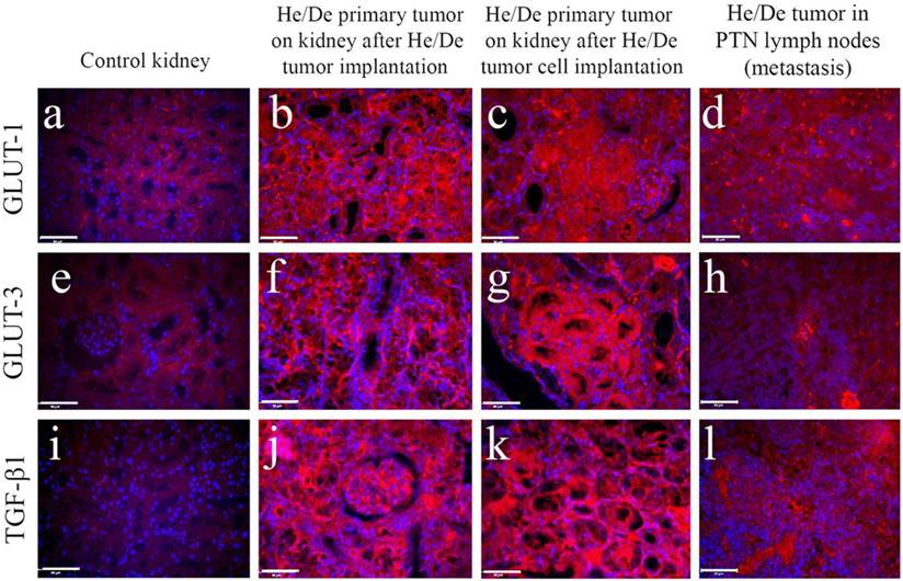 J Cancer Image