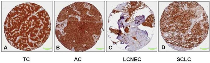 J Cancer Image