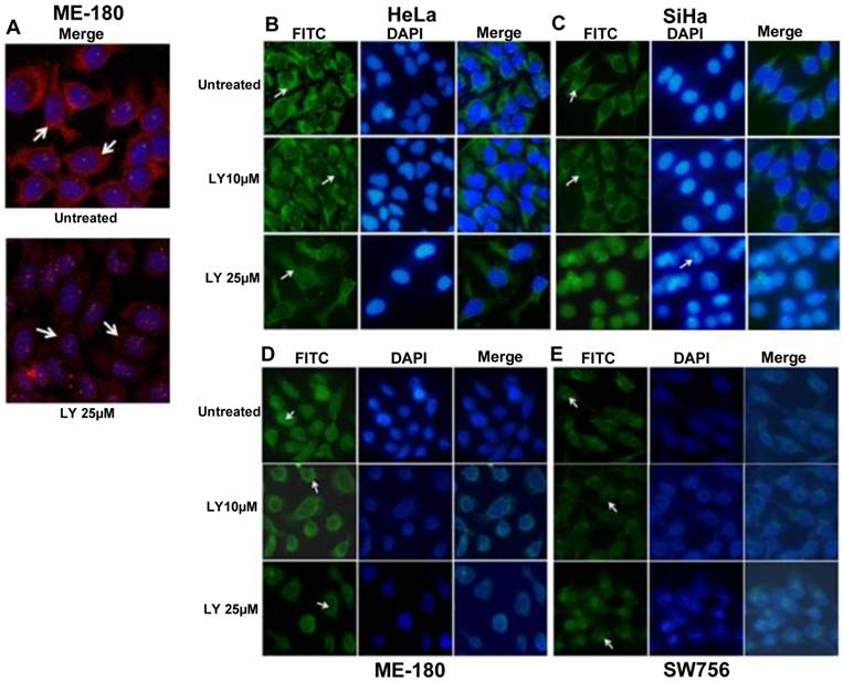 J Cancer Image